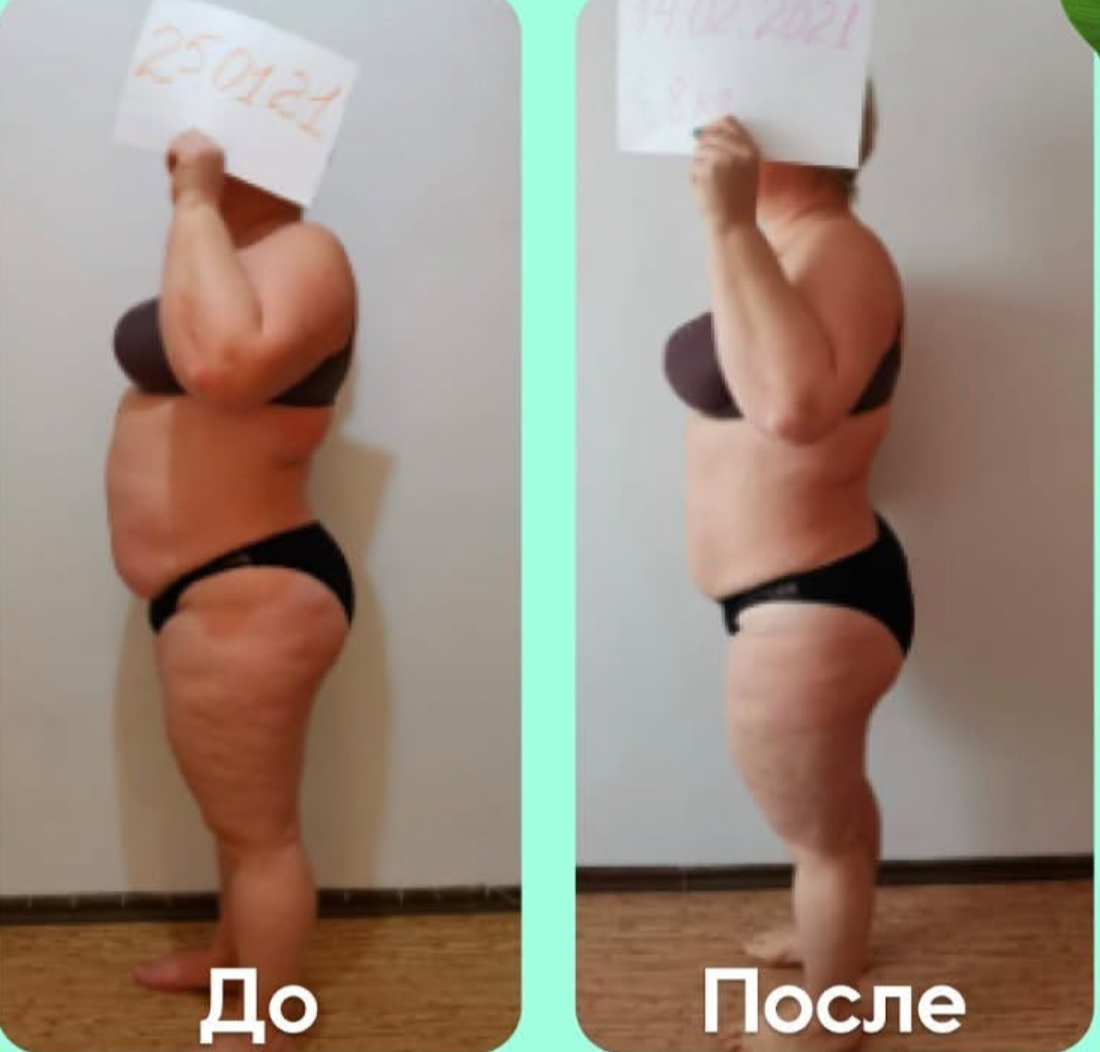Маричка: фото до и после, вид сбоку