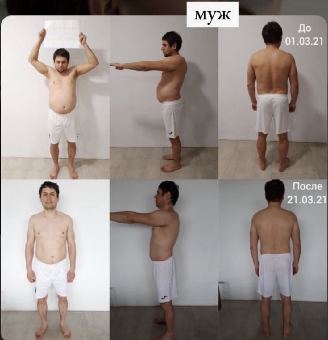 Муж участницы: фото до и после, три ракурса